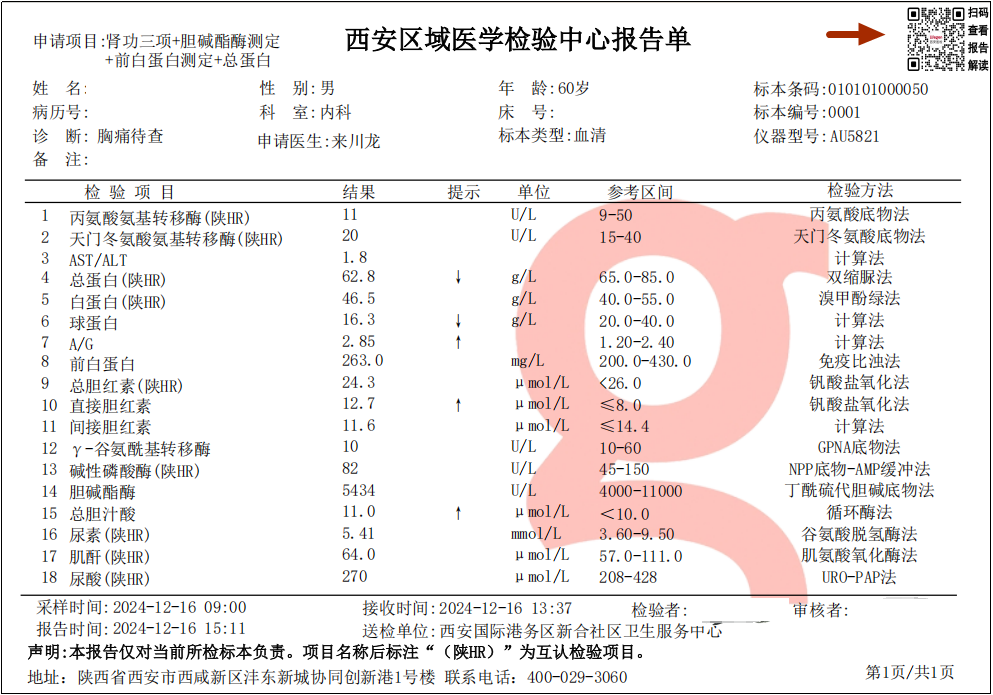 有智慧解读二维码的检验报告单.png